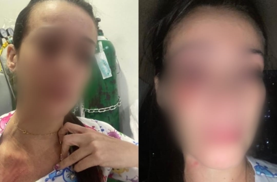 NO ATENDIMENTO: Enfermeira é agredida por mãe de paciente em hospital