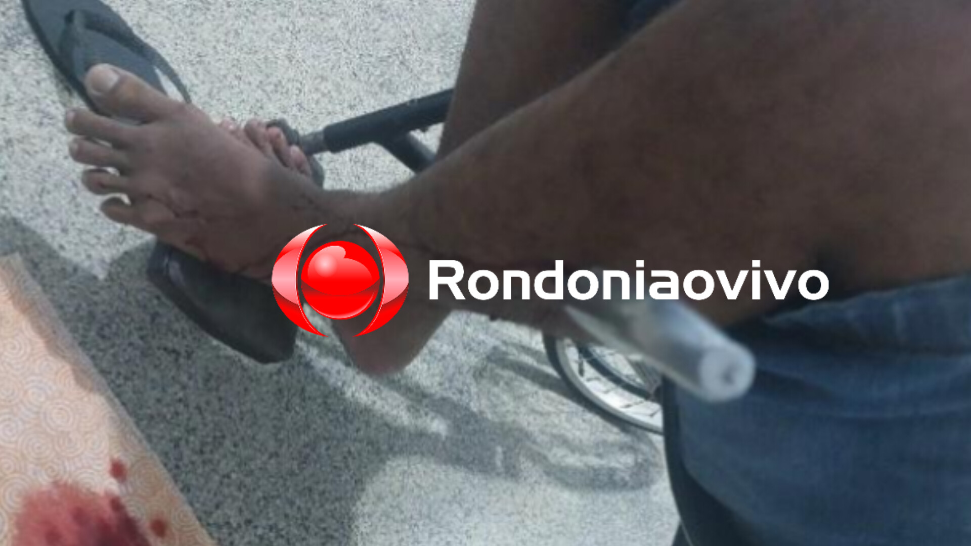 URGENTE: Marido de 30 tem lâmina cravada no corpo pela esposa de 15 anos