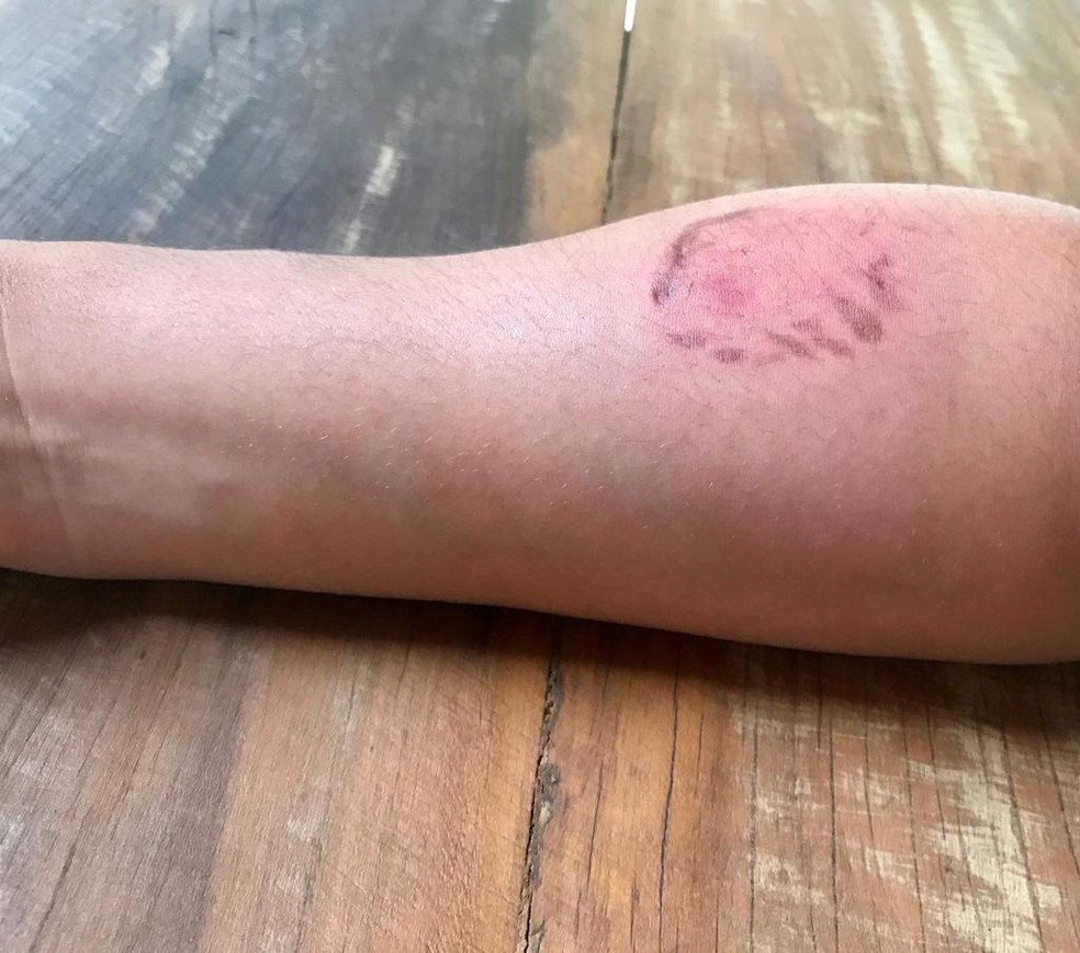 DESCONTROLADA: Jovem ataca namorado e morde oficial da PM durante prisão 