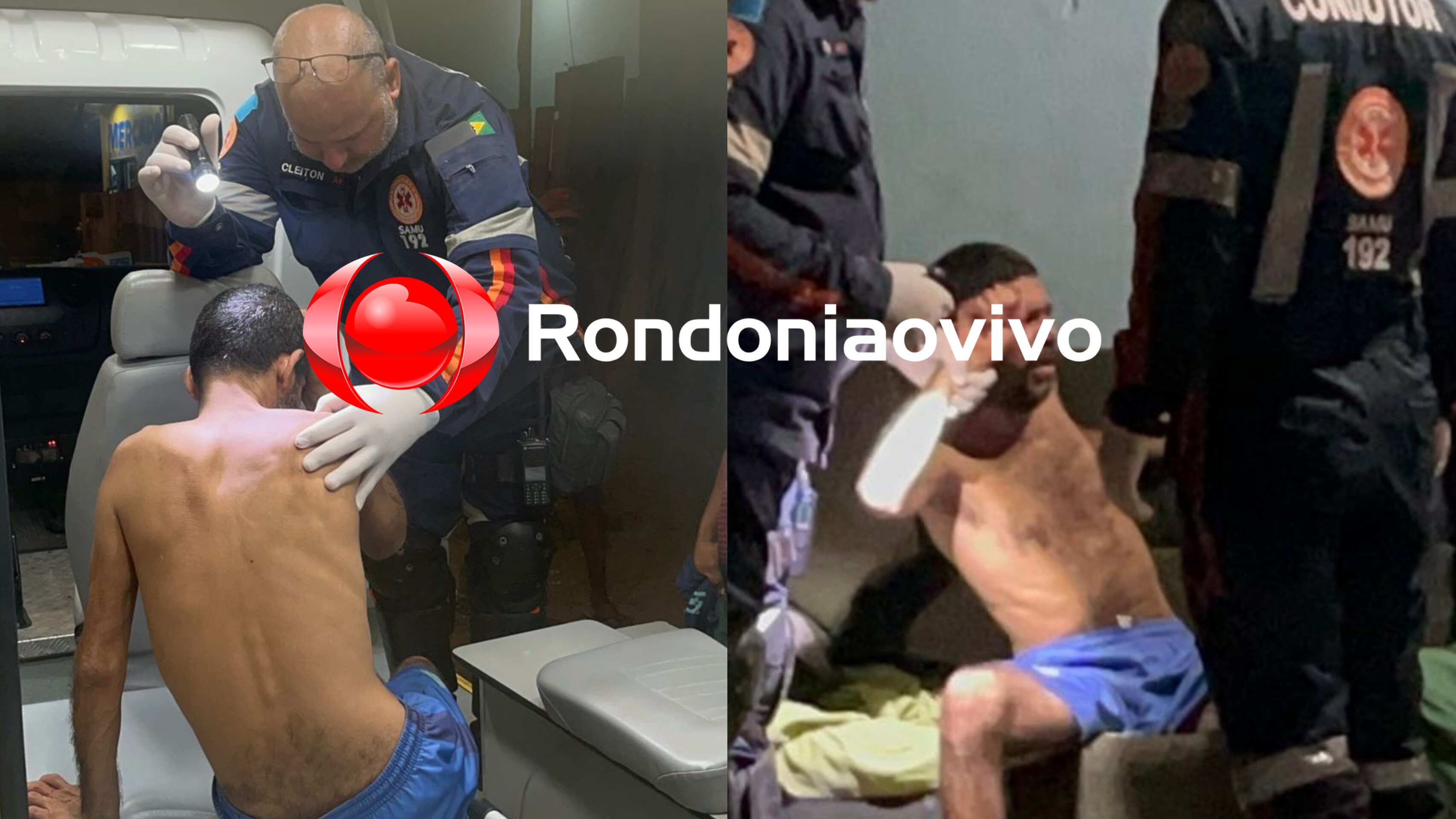 ZONA LESTE: Homem atacado com paulada na testa é socorrido pelo SAMU 