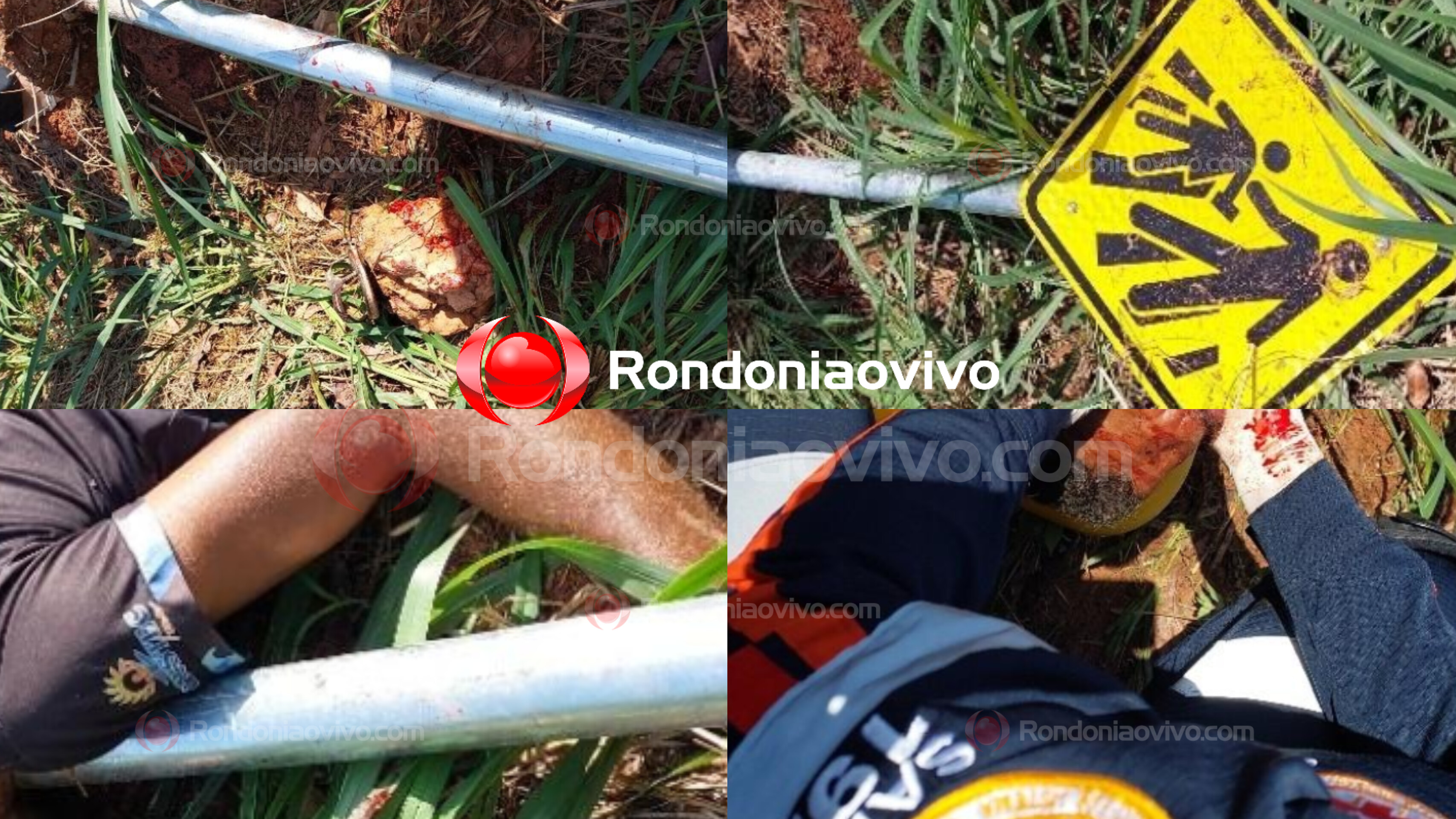 GRAVÍSSIMO: Motociclista fica inconsciente ao passar direto em curva e arrancar placa