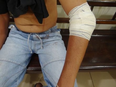 Flanelinha é esfaqueado na região central 
