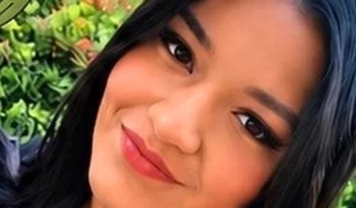 SOLIDARIEDADE: Campanha busca arrecadar R$ 50 mil para reconstrução facial de jovem acidentada