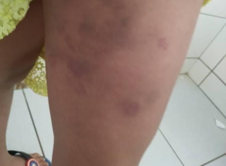 'APÓS NOITADAS': Mulher é atacada a pauladas ao recusar sexo com marido que ficou dois dias na rua