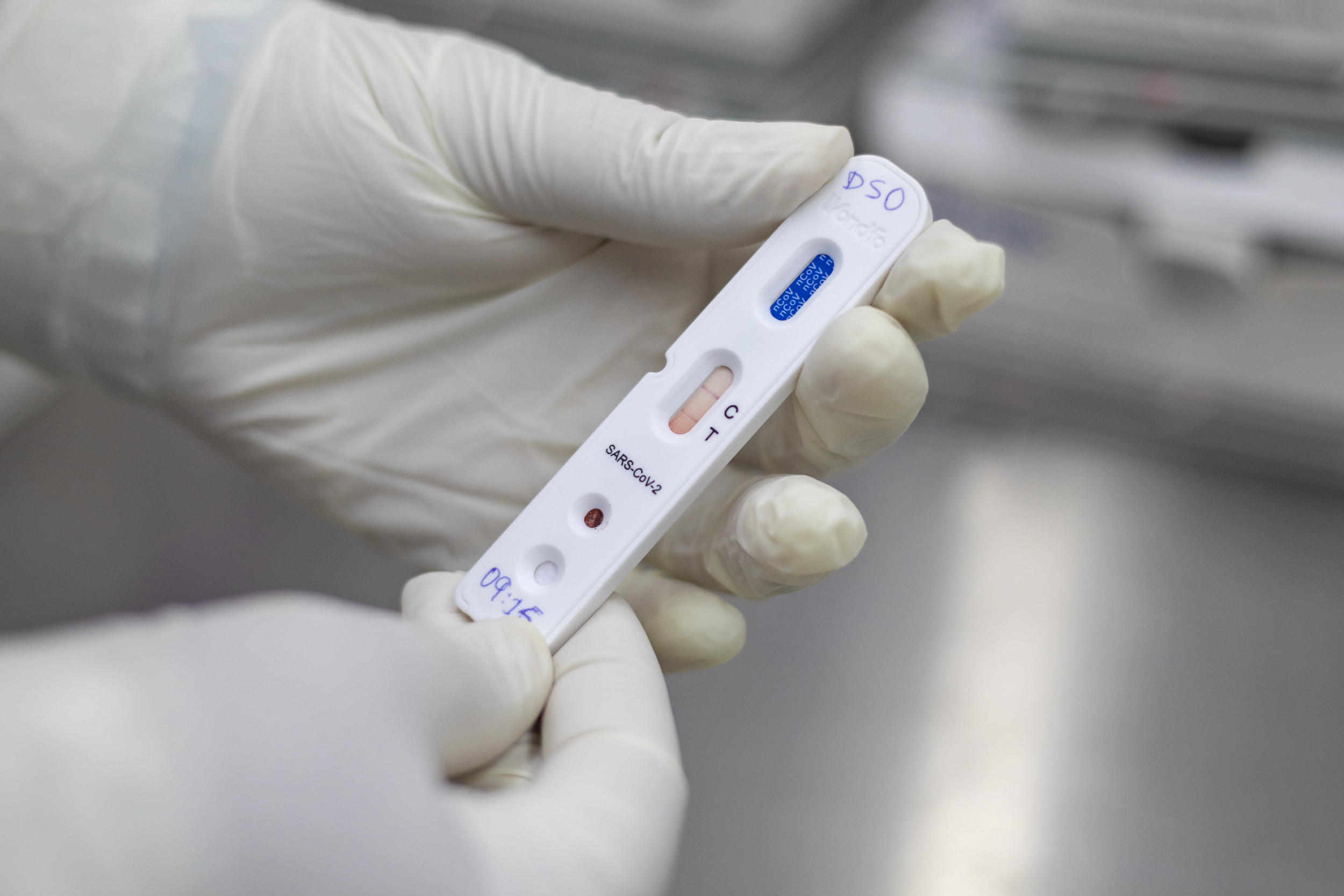 COVID-19: Rondônia registra uma morte e mais 382 casos na quinta (9)