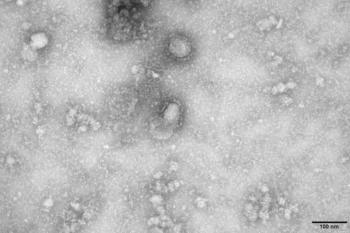 ESTUDOS: Vacina desenvolvida nos EUA poderá impedir propagação do coronavírus