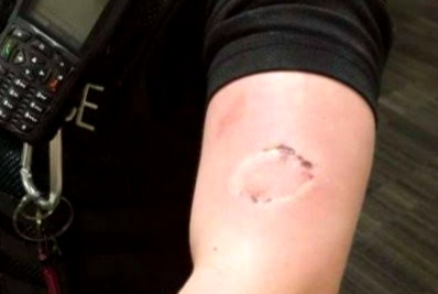 ENSANDECIDA: Mulher é acusada de atacar vizinhos a tesourada e morder policiais militares