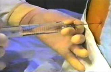 Reunião no MP discute saídas para superar falta de médicos anestesistas em Rondônia