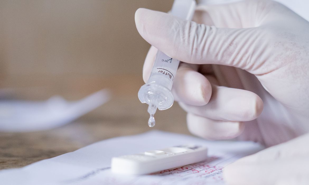 Rondônia confirma uma morte e 734 casos na terça-feira (26)