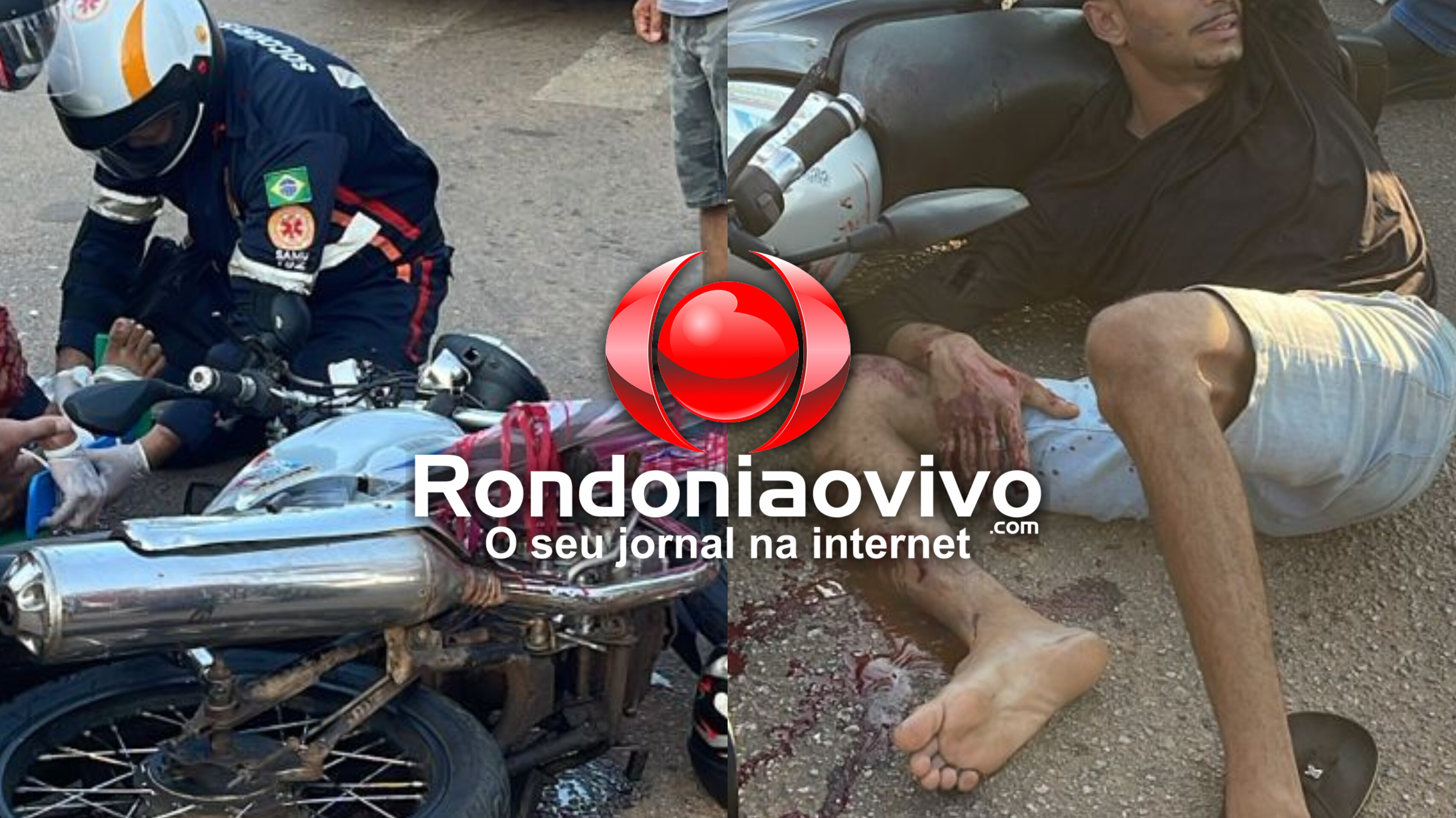 VÍDEO: Motociclista tem fratura exposta após mulher fazer conversão proibida em semáforo