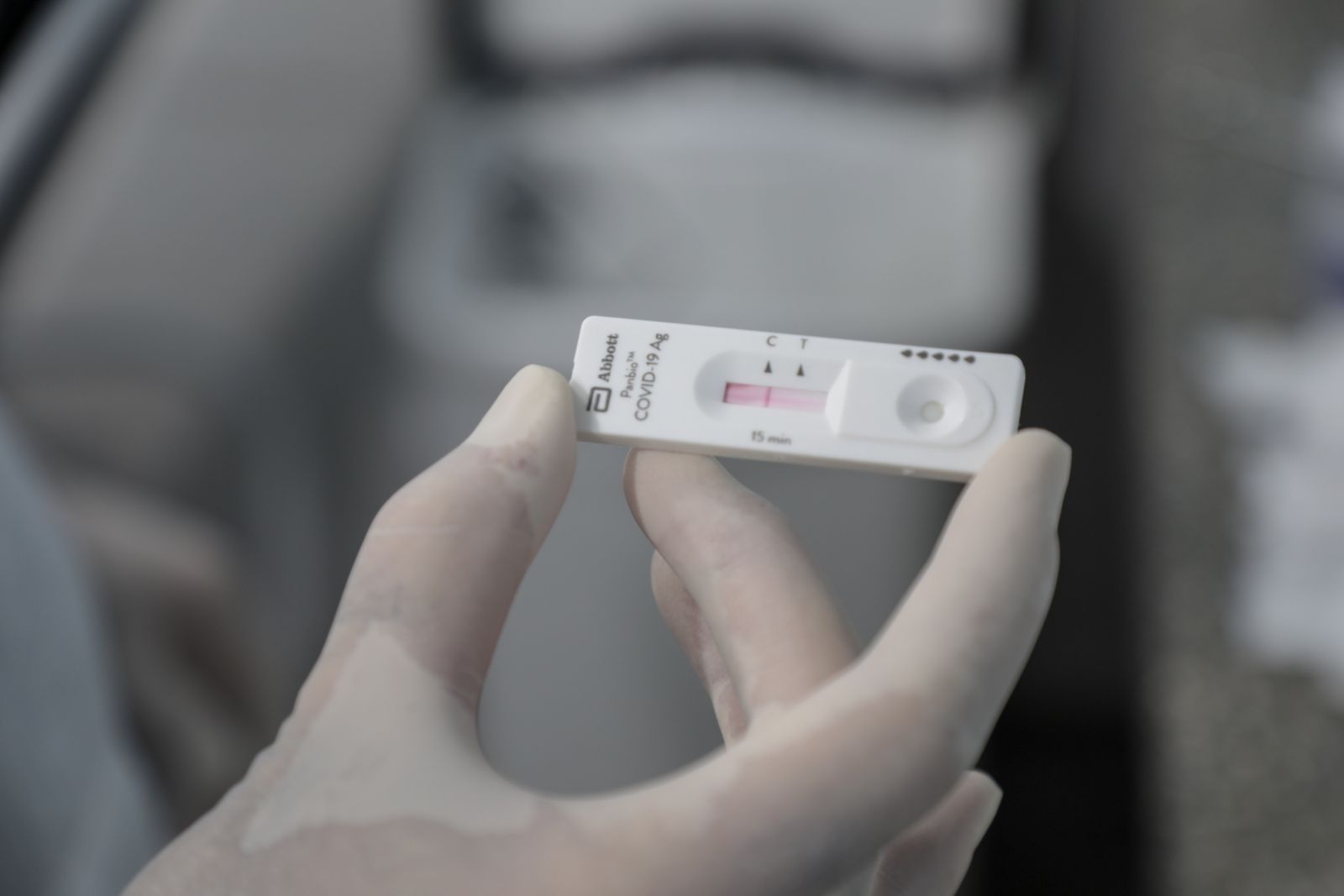 EXAME: Horário para testagem na Policlínica Ana Adelaide será no período da tarde