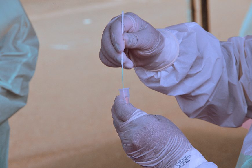 COVID-19: Rondônia registra mais 193 casos e nenhuma morte, aponta Boletim Diário