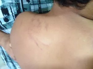 PM ACIONADA: Criança é agredida por mototaxista enquanto brincava na rua de casa