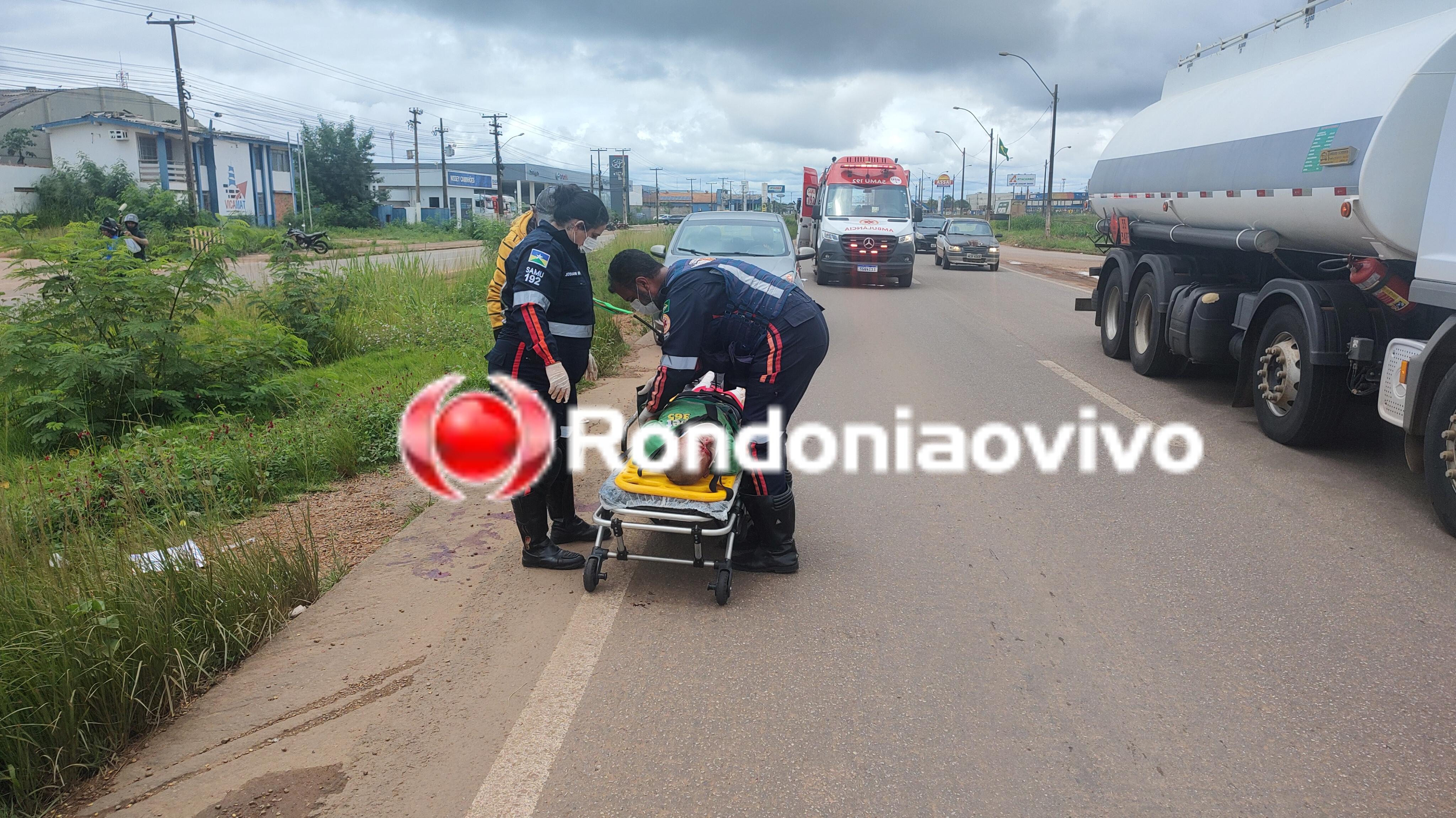 NA BR-364: Idoso tem as duas pernas dilaceradas após ser atropelado por carreta 