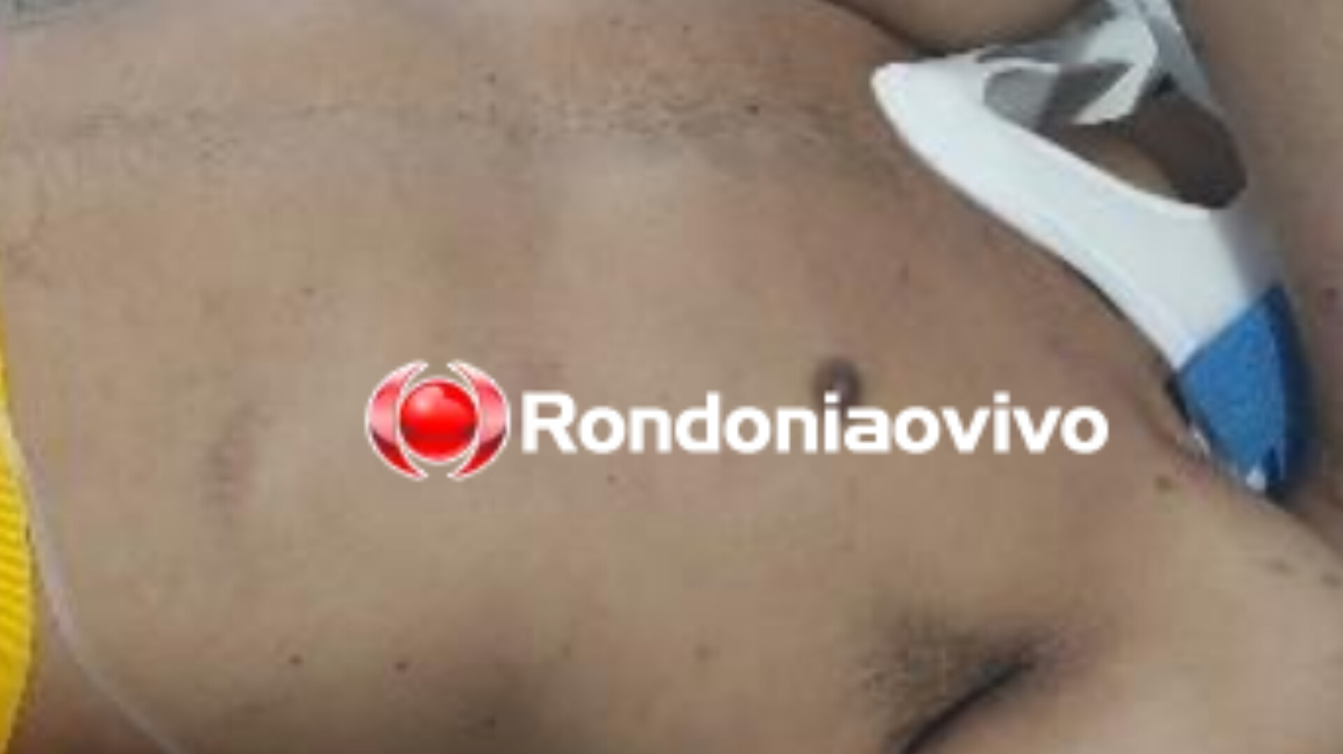 SEM DÓ: Acusado de tentativa de roubo é socorrido inconsciente após espancamento 