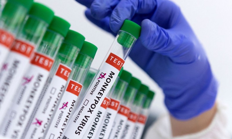ESPERANÇA: Vacina contra a varíola dos macacos deve chegar ao Brasil este mês