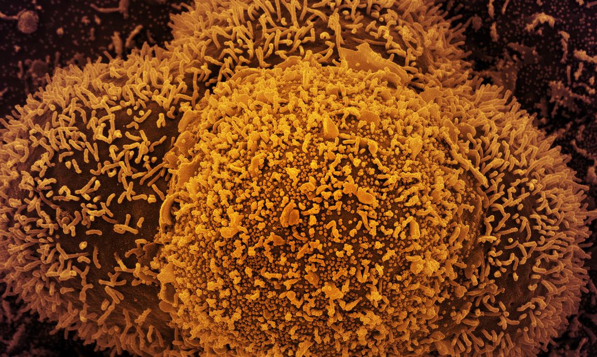 PANDEMIA: Fiocruz confirma casos da linhagem BA.2 da variante Ômicron