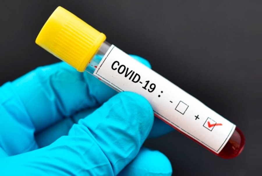 DIMINUIÇÃO: Rondônia registrou 10 casos de Covid-19 e nenhuma morte