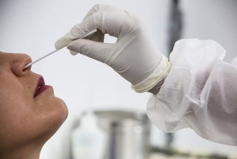 AUMENTO: Agevisa registra 79 casos de covid e nenhuma morte, em RO  