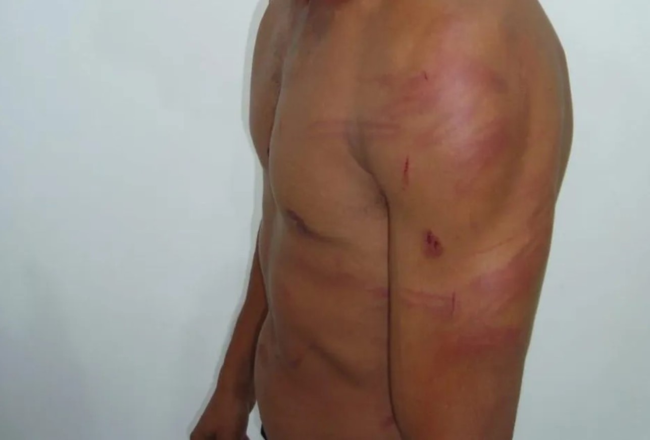 SENTIU CIÚMES: Mulher surra ex-marido após encontrar foto antiga dele com outra