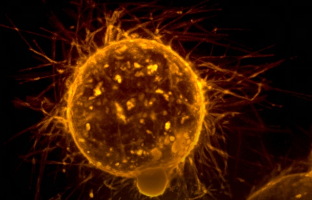 EXPERIMENTO: Cientistas descobrem possível forma de desativar progressão do câncer