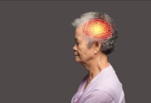 NEURODEGENERATIVA: Cientistas acabam de encontrar nova causa do Alzheimer