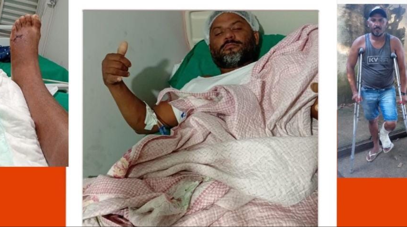 SOLIDARIEDADE: Acidentado e sem renda, trabalhador pede ajuda