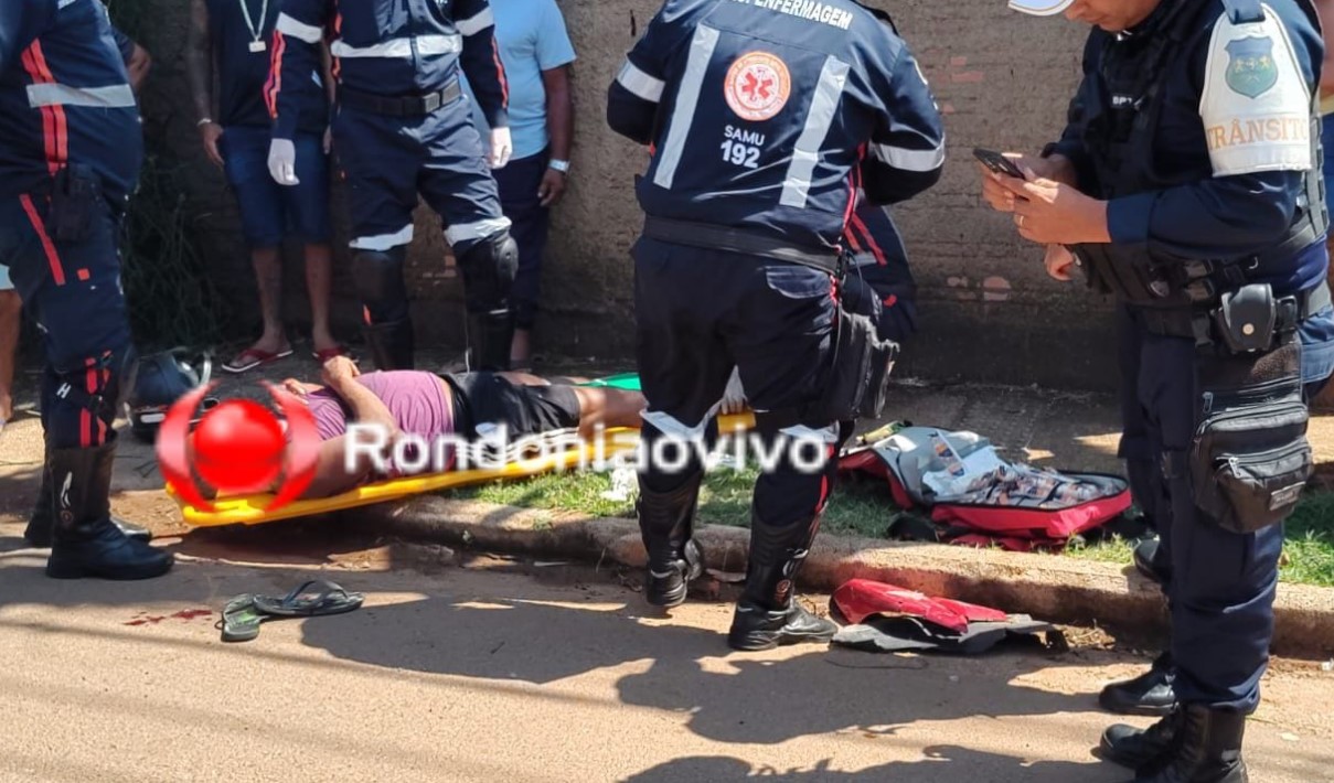 NA AMADOR: Batida entre motos deixa homem com fratura exposta na perna