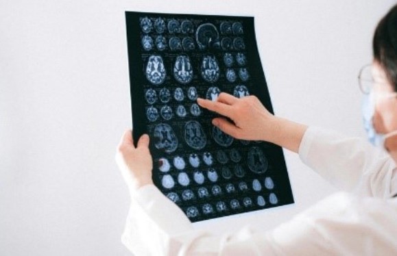 SURPREENDENTE: Cientistas descobrem três idades críticas em que o cérebro envelhece 