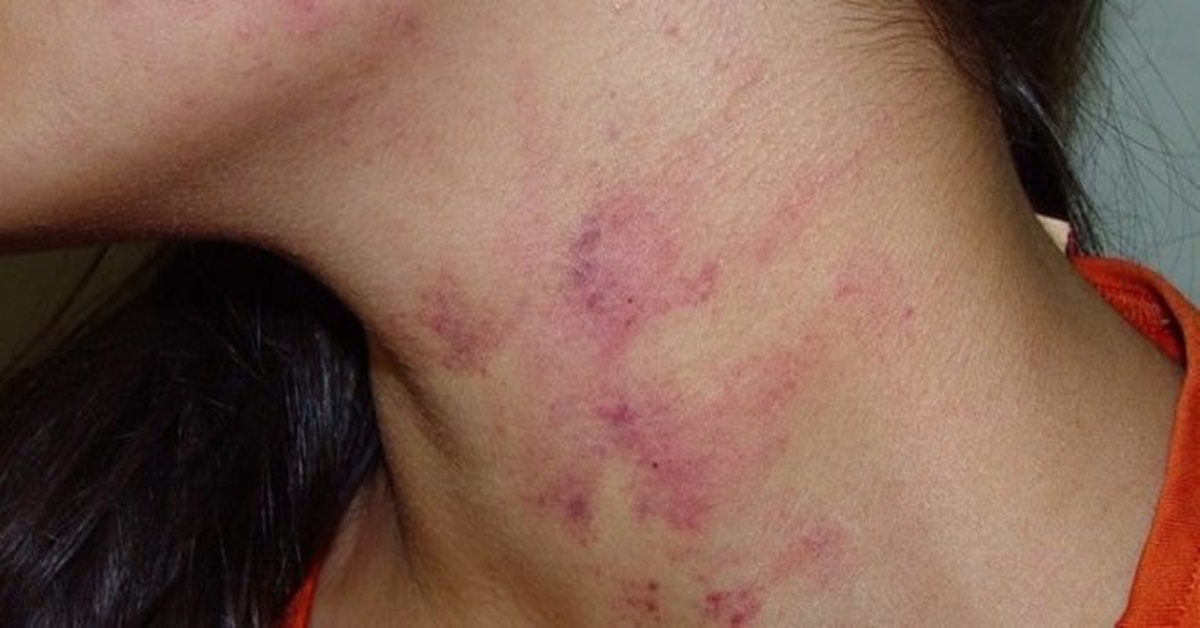 VIOLÊNCIA DOMÉSTICA: Após sair da igreja, mulher pede carona para ex-marido e acaba surrada