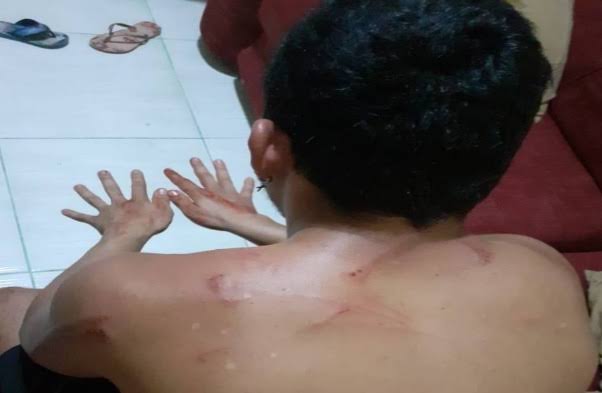 APANHOU: Homem aciona a polícia após ser espancado por ex-mulher