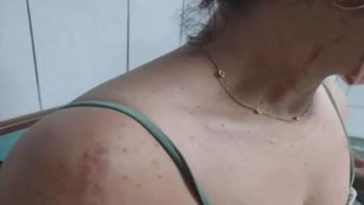 EMBRIAGADO: Marido passa a madrugada bebendo na rua e chega em casa espancando mulher