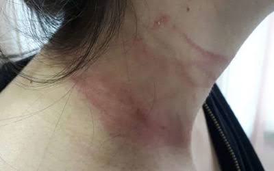 INCONFORMADO: Ex-marido invade residência e tenta matar mulher estrangulada