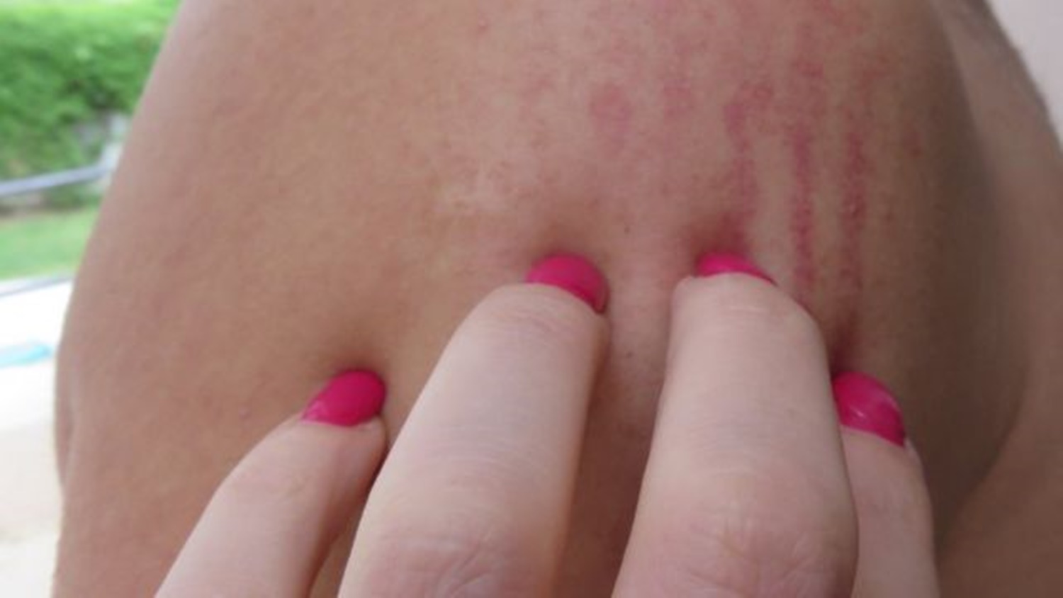 DIA DA MULHER: Casal briga por ciúmes e homem vai parar na UPA