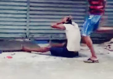 ESPANCADO: Morador de rua tem nariz fraturado ao pedir comida de comerciante