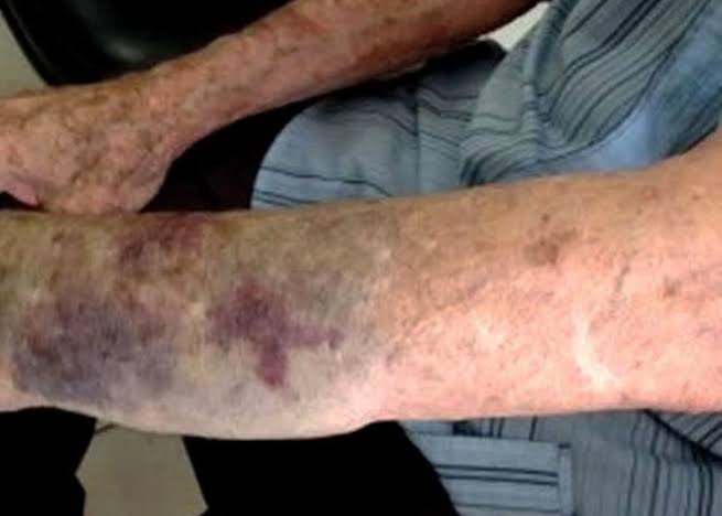 VICIADO: Filho ameaça matar o pai por causa de dinheiro para usar drogas