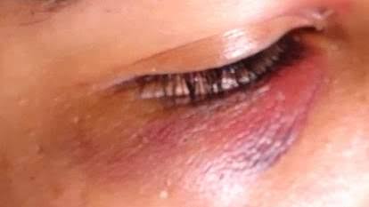 COVARDIA: Servidor público é acusado de espancar a namorada com ajuda do filho