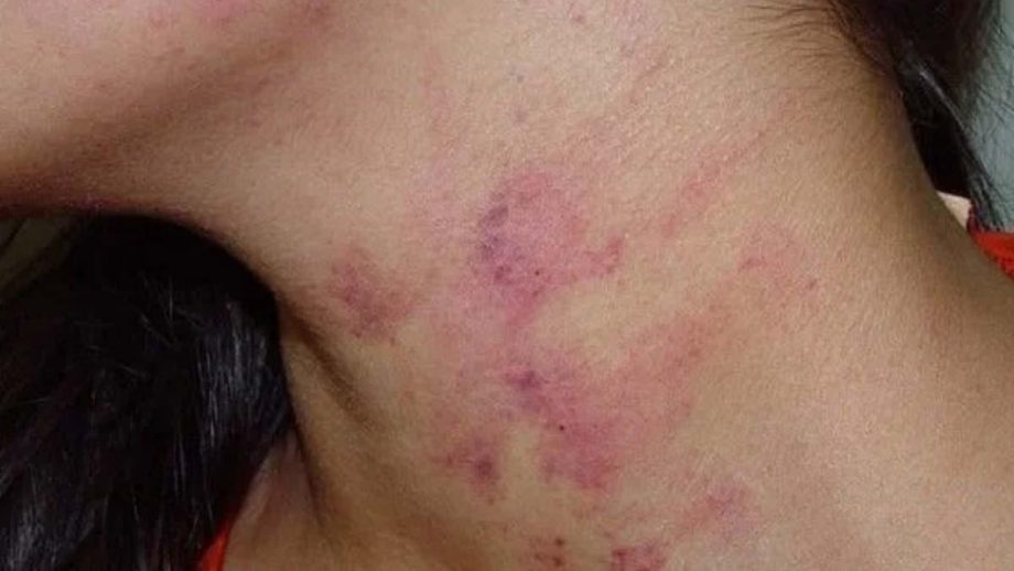 BRUTALIDADE: PM prende homem que fez mulher perder o bebê após espancá-la