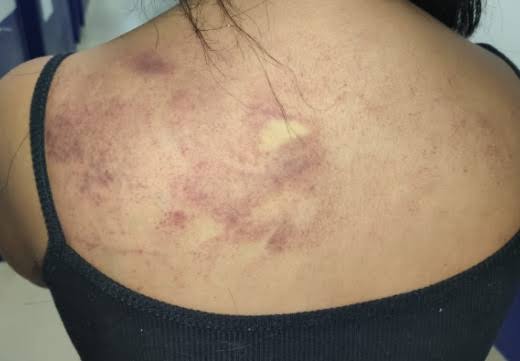 COVARDIA: Sargento da PM é acusado de espancar a mulher após bebedeira em aniversário