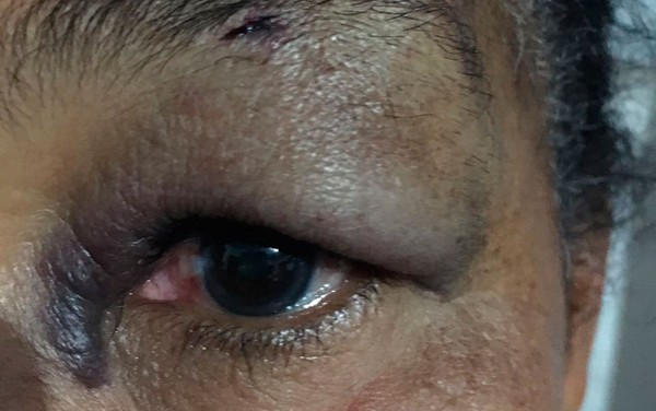 'VELHA SAFADA': Nora é acusada de invadir casa, xingar e surrar a sogra 