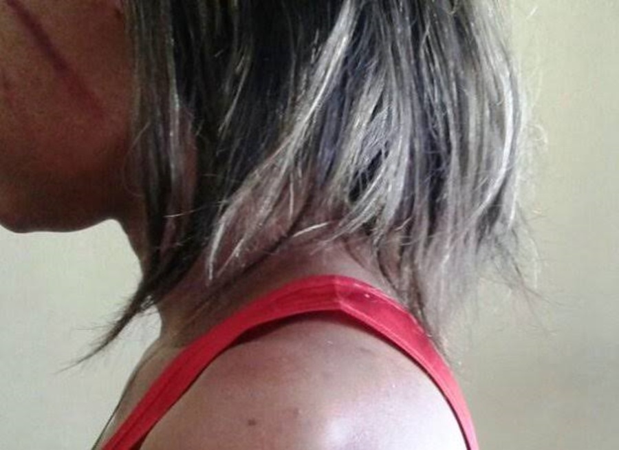 IRMÃO AGRESSOR: Namoradas são espancadas após tentarem separar briga de casal