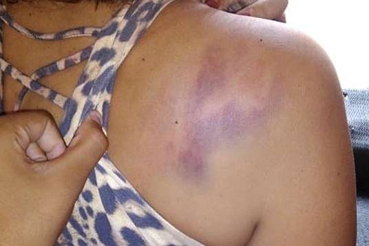 APÓS BEBEDEIRA: Mulher é espancada pelo marido ao chegar em casa de madrugada