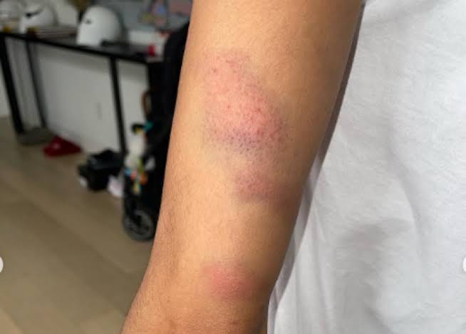 NÃO GOSTOU: Mulher vai pedir leite para o filho e é espancada pela atual do ex-marido