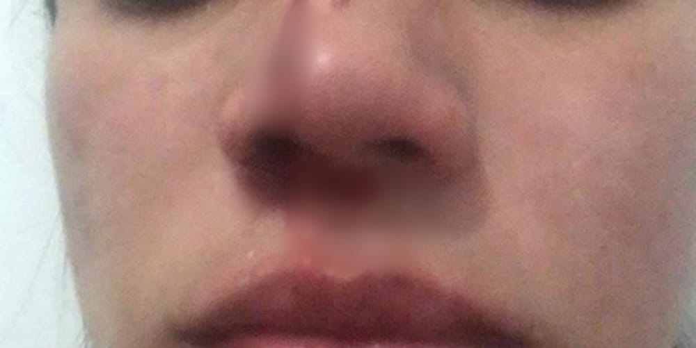 APÓS DISCUSSÃO: Enteada é agredida a cabeçada pelo padrasto e aciona a polícia 