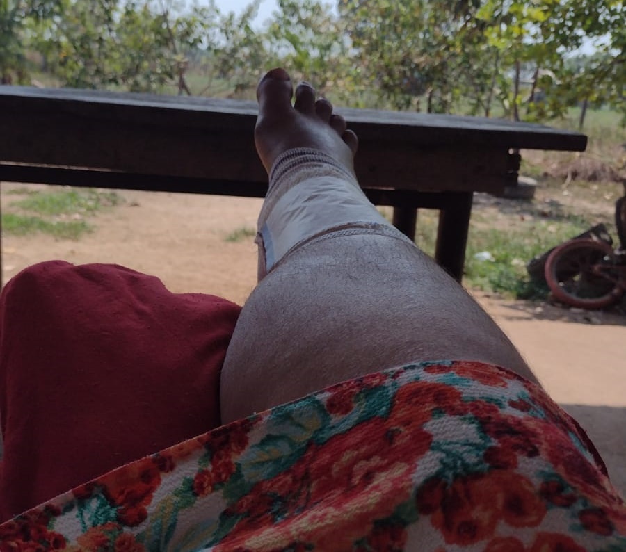 DESESPERO: Família está sem alimento após mãe sofrer acidente e não poder trabalhar