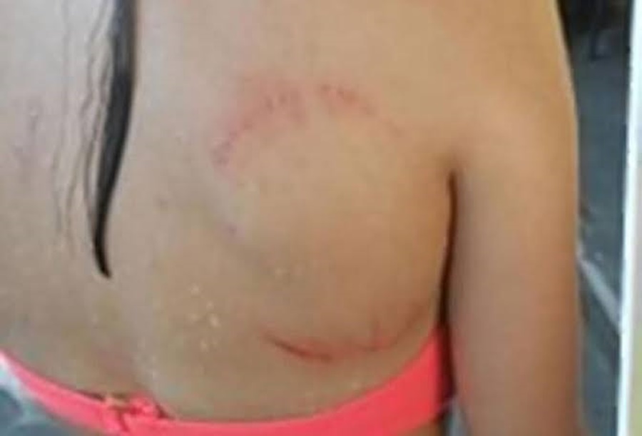 'ACABEI DE LIMPAR': Marido ataca esposa a mordidas após lavar varanda e enteada sujar 