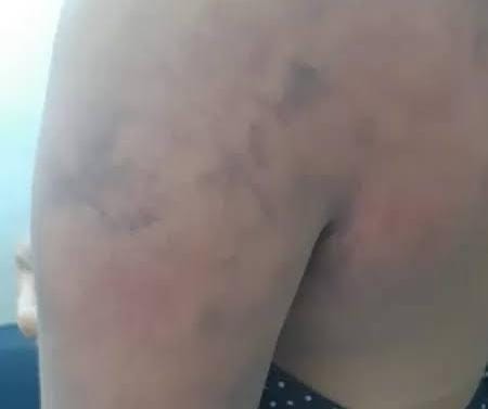 NÃO ACEITOU: Cozinheira é vítima de agressão após pedir a separação ao marido 