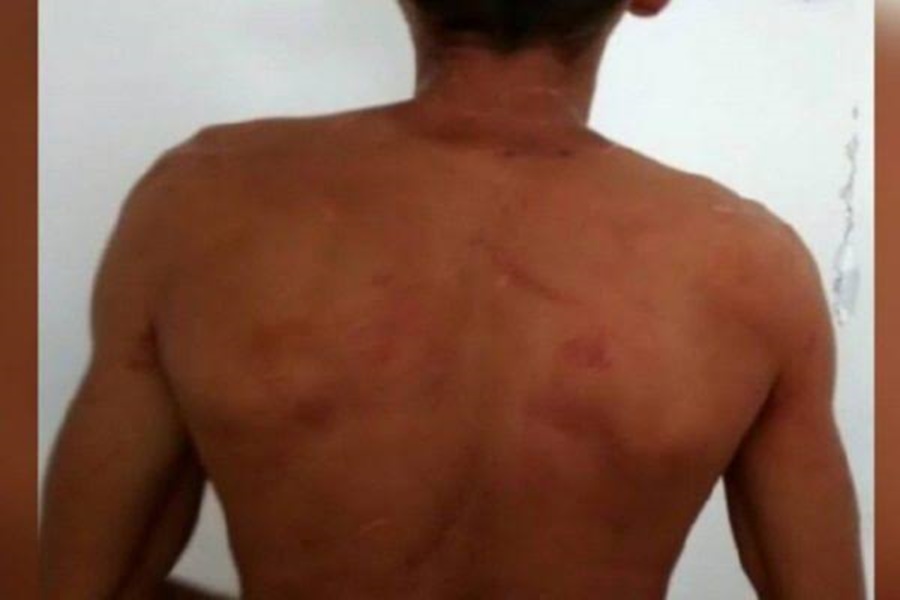 SEPARADOS: Servidor público é agredido a capacetadas por cabeleireira em bar 