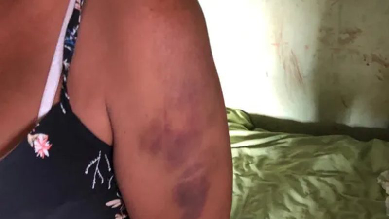 APÓS DISCUSSÃO: Esposa é agredida a capacetadas e jogada de motocicleta pelo marido 