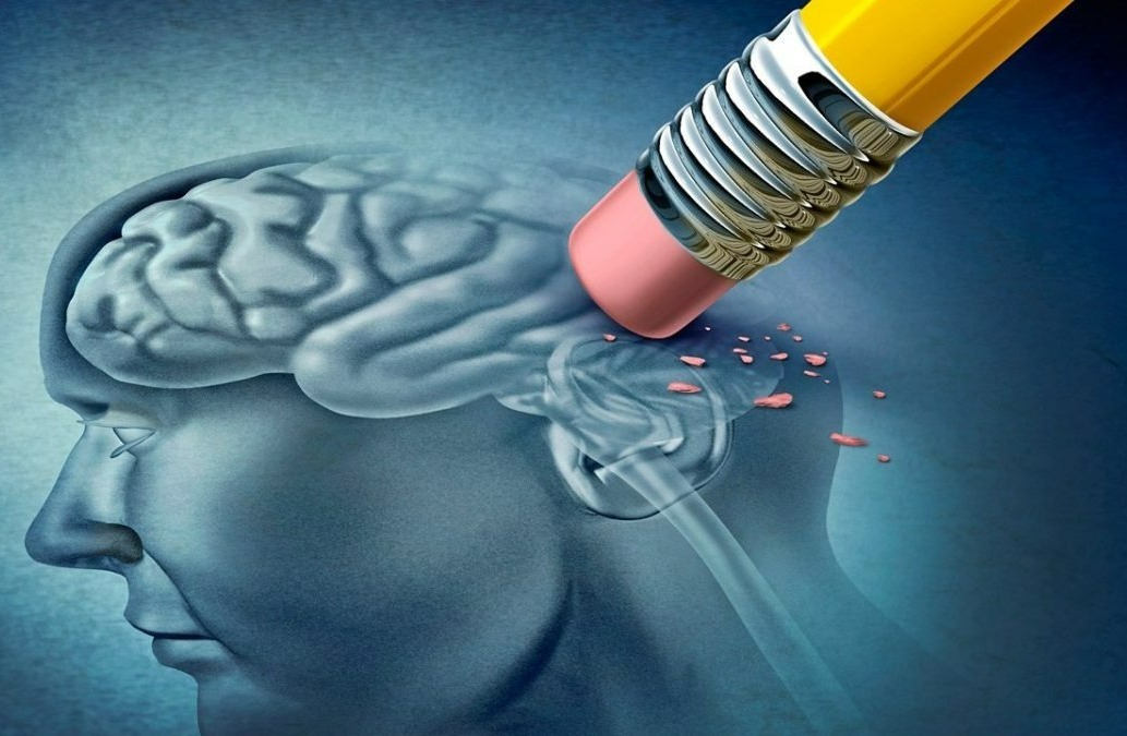 ALZHEIMER: Proteína acumulada no cérebro pode influenciar mais que a idade